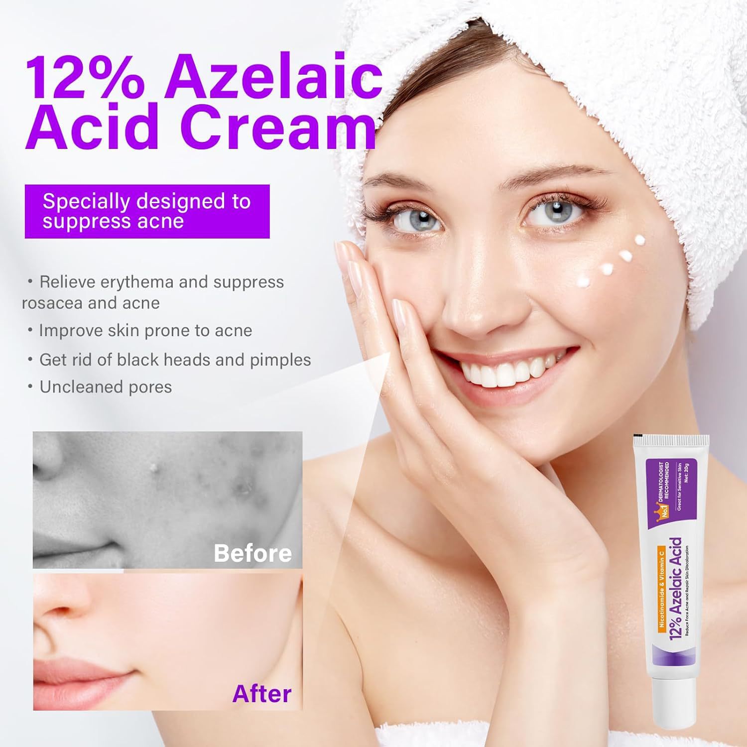 Azelaic Acid Serum, Niacinamide Ointment, Soothing Skin Gel For Fading Acne Scars And Pimples